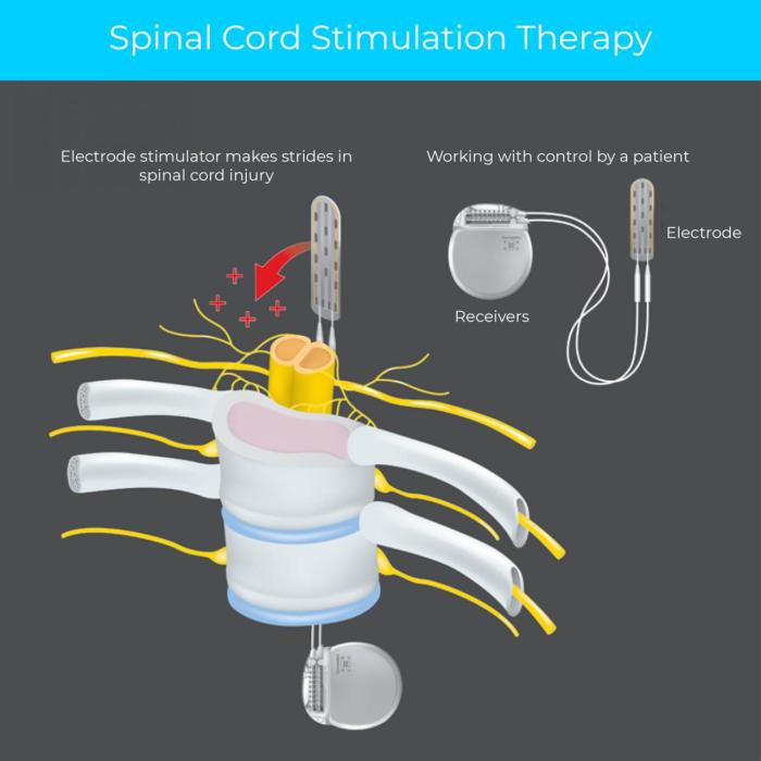 Medtronic inceptiv spinal cord stimulator