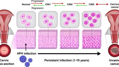 What does hpv diagnosis mean sti