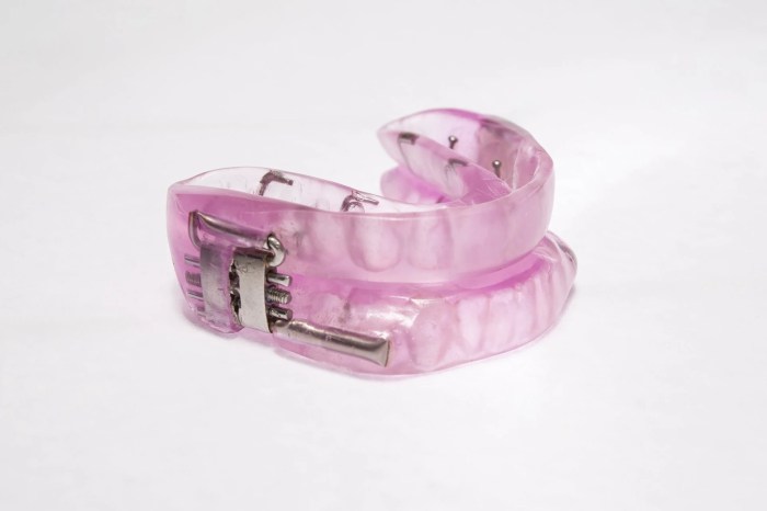 Sleep apnea treatments cpap machine