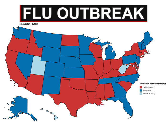 Bird flu united states severe case h5n1 explainer