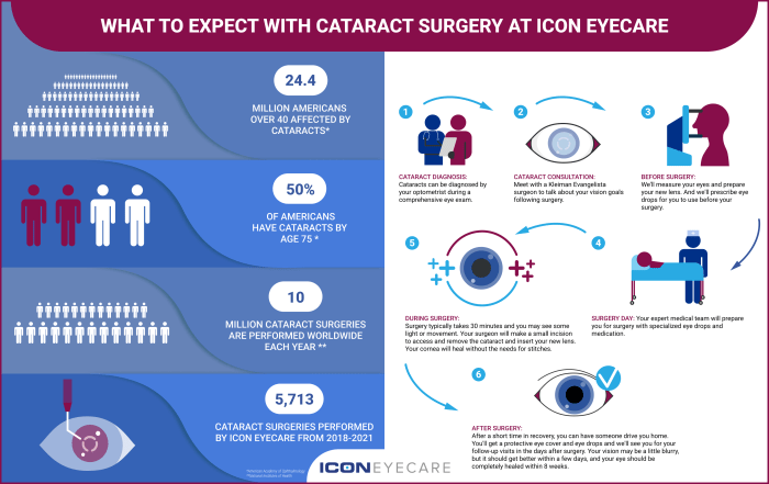 Cataract surgery what to expect